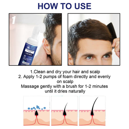 East Moon Men's Dense Hair Foam Machine, Repair Hair Root Follicle Men's Hair Thick Moisturizing Foam