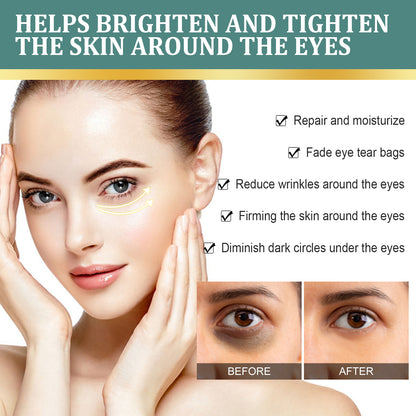EELHOE Light Dark Circles Eye Cream, Gentle And Moisturizing, Lightening Fine Lines, Tightening Eye Bags, And Anti-Aging Eye Cream Around The Eyes