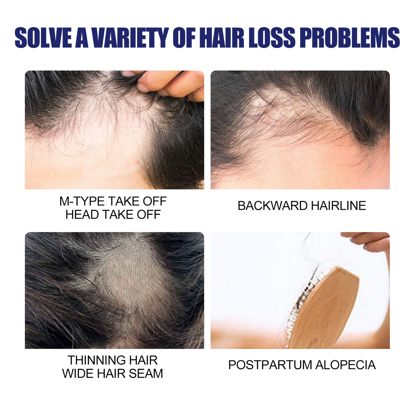East Moon Men's Dense Hair Foam Machine, Repair Hair Root Follicle Men's Hair Thick Moisturizing Foam