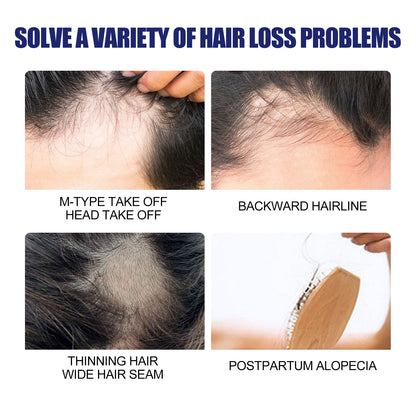 East Moon Men's Dense Hair Foam Machine, Repair Hair Root Follicle Men's Hair Thick Moisturizing Foam