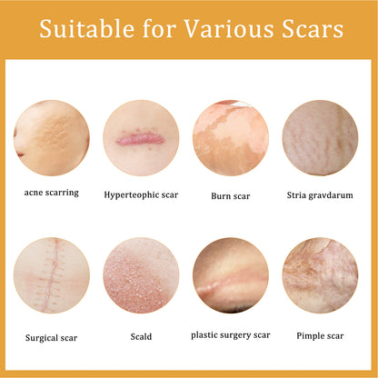 Desalting Skin Scar Cream, Skin Burn Scalding Surgical Scar Wound Repair Cream