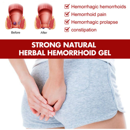 Strong Natural Herbal Hemorrhoid Gel, Repair Anal Relief Itching Discomfort And Hemorrhoid Treatment Gel