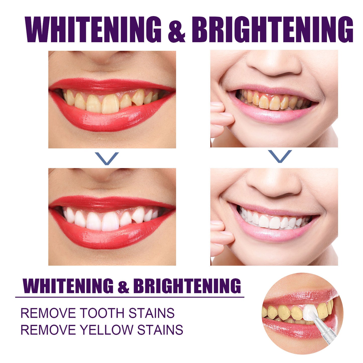V34 Purple Dental Pen Oral Cleaning, Removing Stains And Brightening Teeth Oral Care Dental Pen