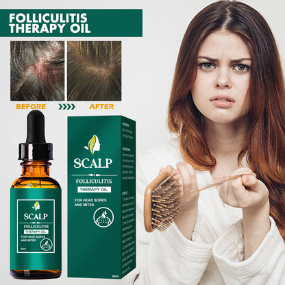 Essential Oil For Scalp, And Hair Scalp Deep Cleaning And Repair Hair Root Anti-Itching And Anti-Loss Hair Solid Care Essential Oil