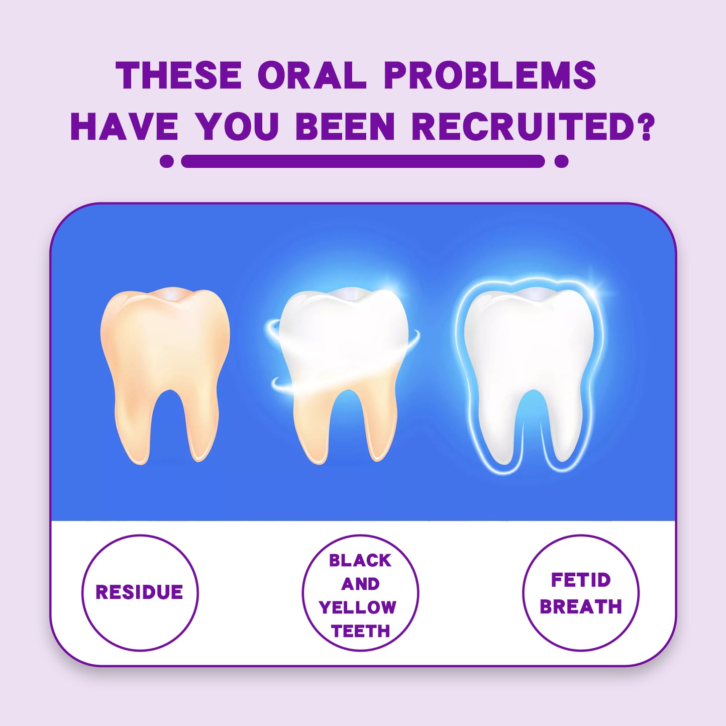 EELHOE Probiotic Toothpaste, Cleaning Stains And Tartar Fresh Breath Whitening Toothpaste
