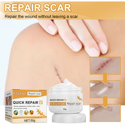 Desalting Skin Scar Cream, Skin Burn Scalding Surgical Scar Wound Repair Cream