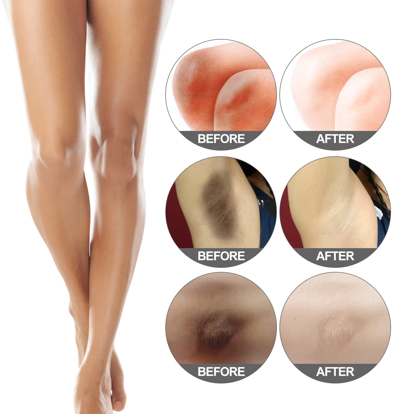 Jaysuing Brightening Cream Repair Dull Joints Under The Armpits, Dark Brightening, Moisturizing And Rejuvenating Body Cream
