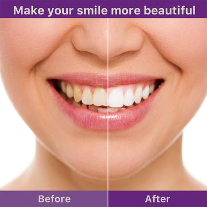 OUHOE Tooth Cleaning Mousse, Anti-Decay Clean Teeth Tartar Breath Fresh Whitening Teeth Toothpaste