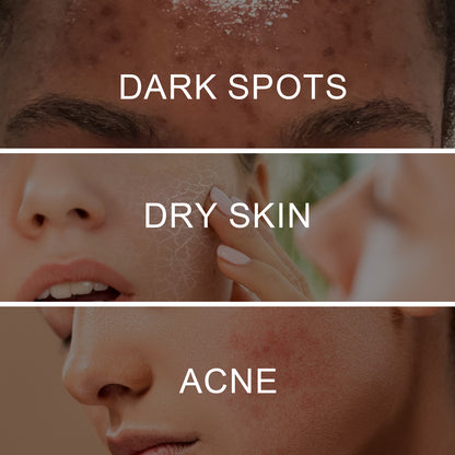 Retinol Pigment Correcting Spray, Lightening Spots Moisturizing Whitening Skin Care Spray