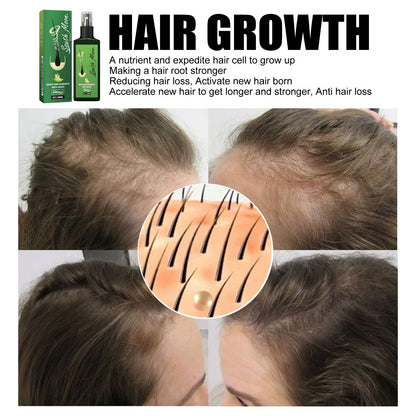 South Moon Hair Care Spray Nourishing And Nourishing Hair Massage Repair Hair And Scalp Care Solution