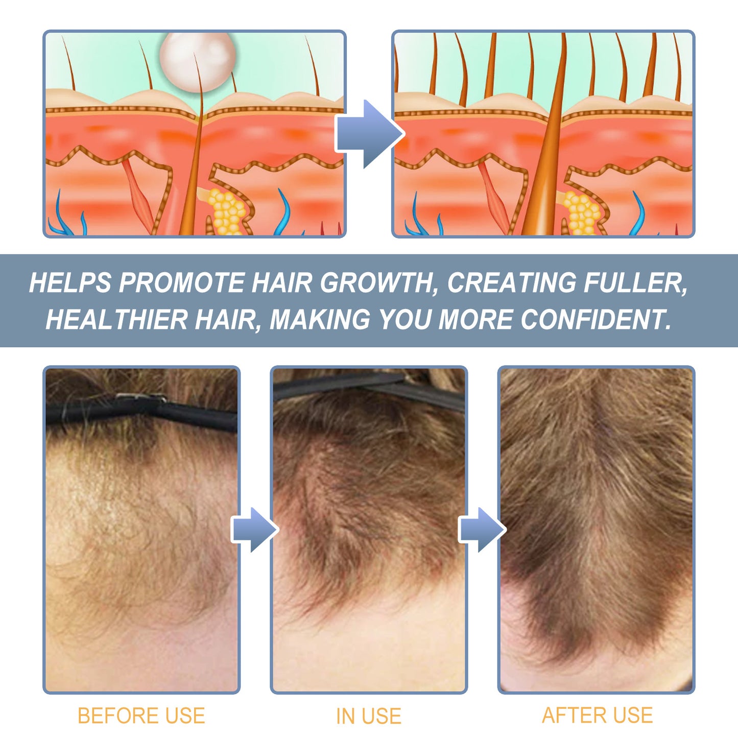 Nourishing Hair Scrub, Clean Scalp Skin Soft Moist Hair Care Scrub