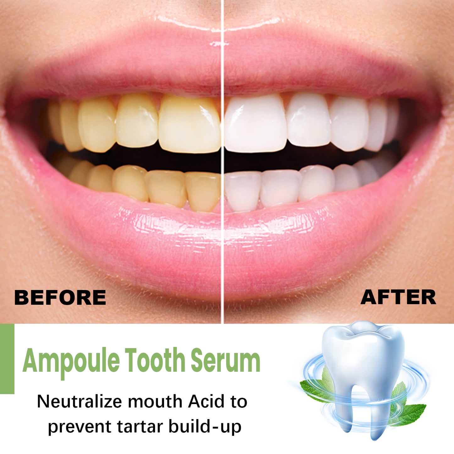 EELHOE Teeth Whitening Serum To Remove Stains, Bad Breath, Whitening Teeth And Whitening Teeth