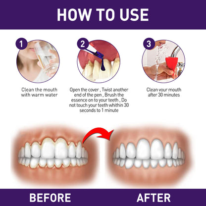 West&Month Gum Corrector Pen, Teeth Cleaning Whitening Brightening Repair Gum Teeth Beauty Pen