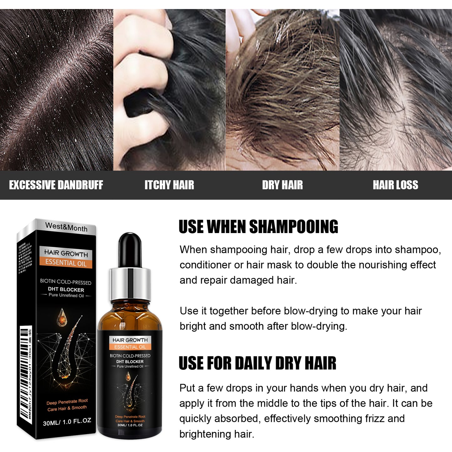 Hair Growth Essential Oil, Dense Hair Growth Repair Dry Hair And Moisture Hair Essence