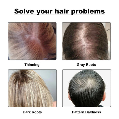 Hairline Powder, Fill In The Top Of Your Hairline With A Refreshing Fluffy Shade Powder