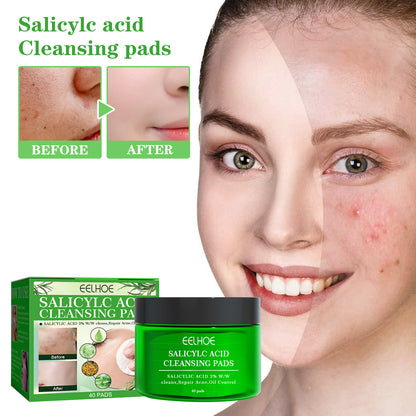 Salicylic Acid Cleaning Gasket, Moisturizing Oil Control Removing Blackheads And Acne Closing Gentle Cleansing Acne Muscle Repair