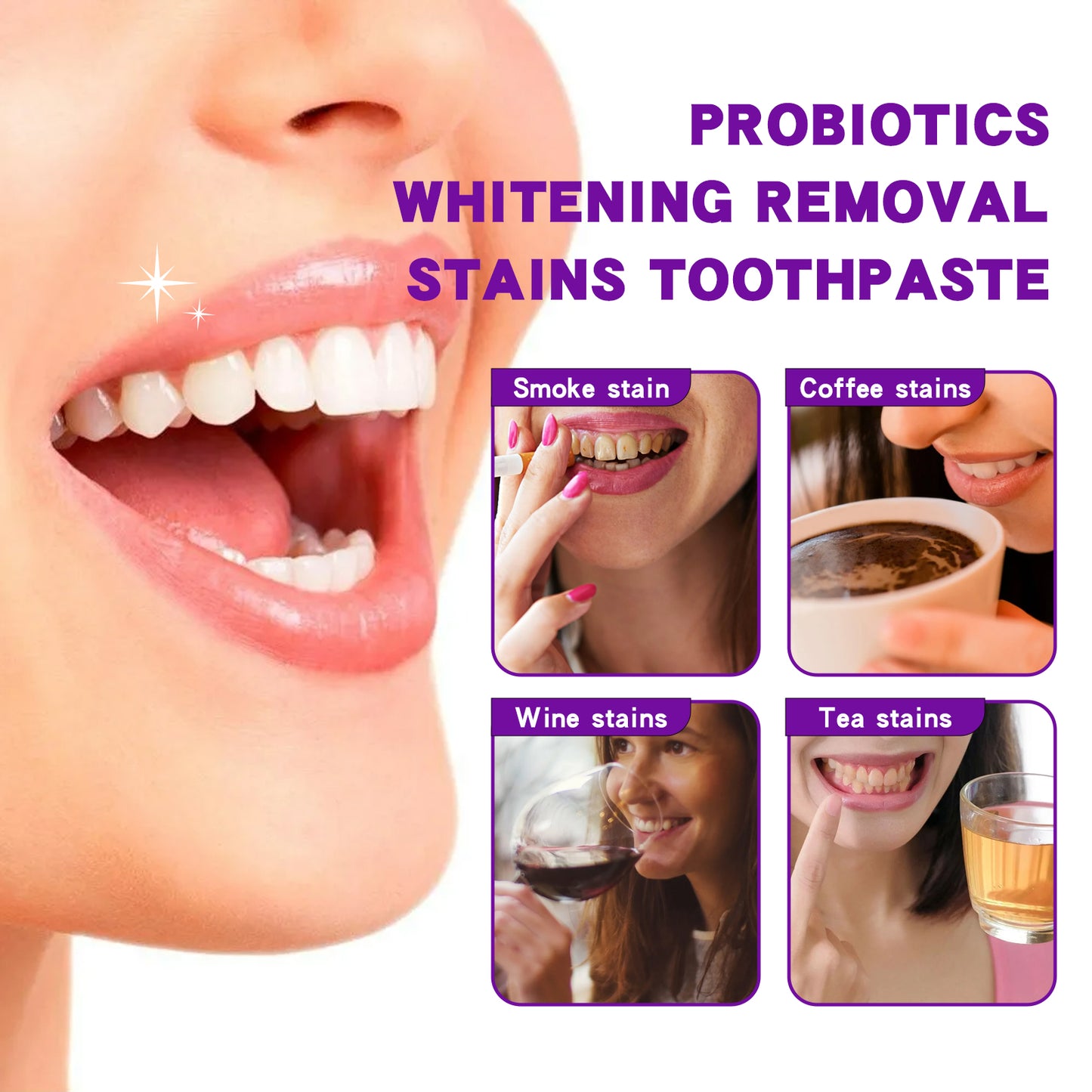 EELHOE Probiotic Toothpaste, Cleaning Stains And Tartar Fresh Breath Whitening Toothpaste