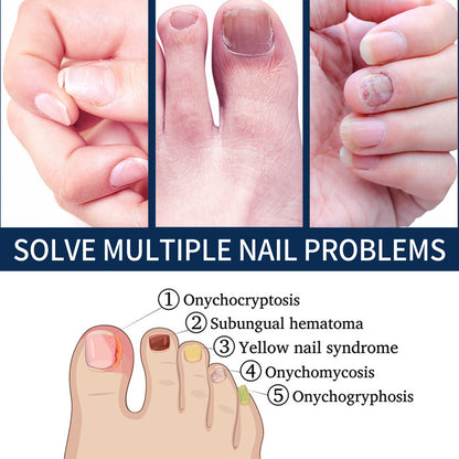 Nail Repair Relieve Essence Pen, Moisturizing Repair Hand And Foot Inlay Nail Thickening Grey Nail Correction Pen